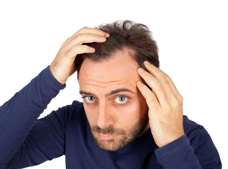 Hair Loss